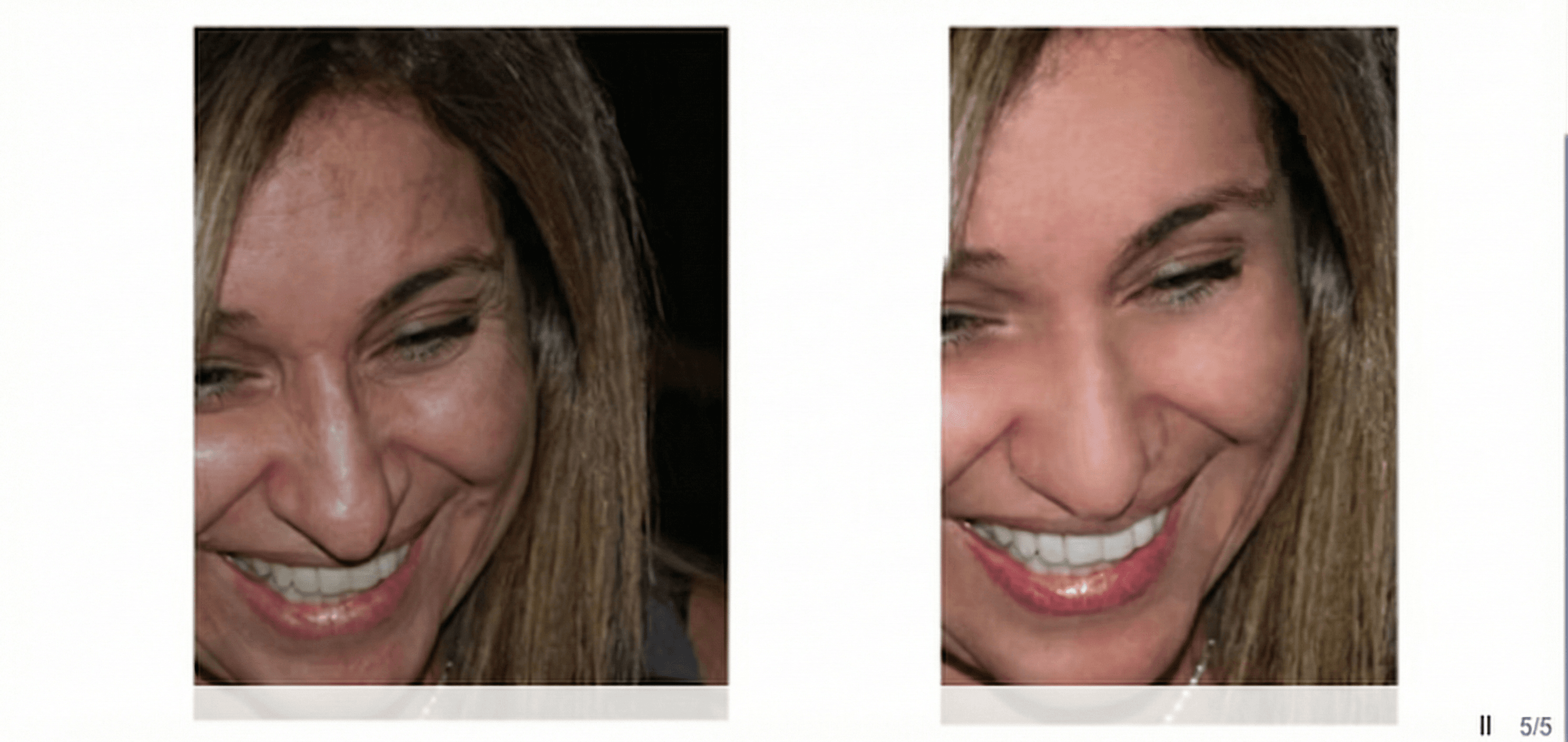 Cosmetic digital surgery example 2