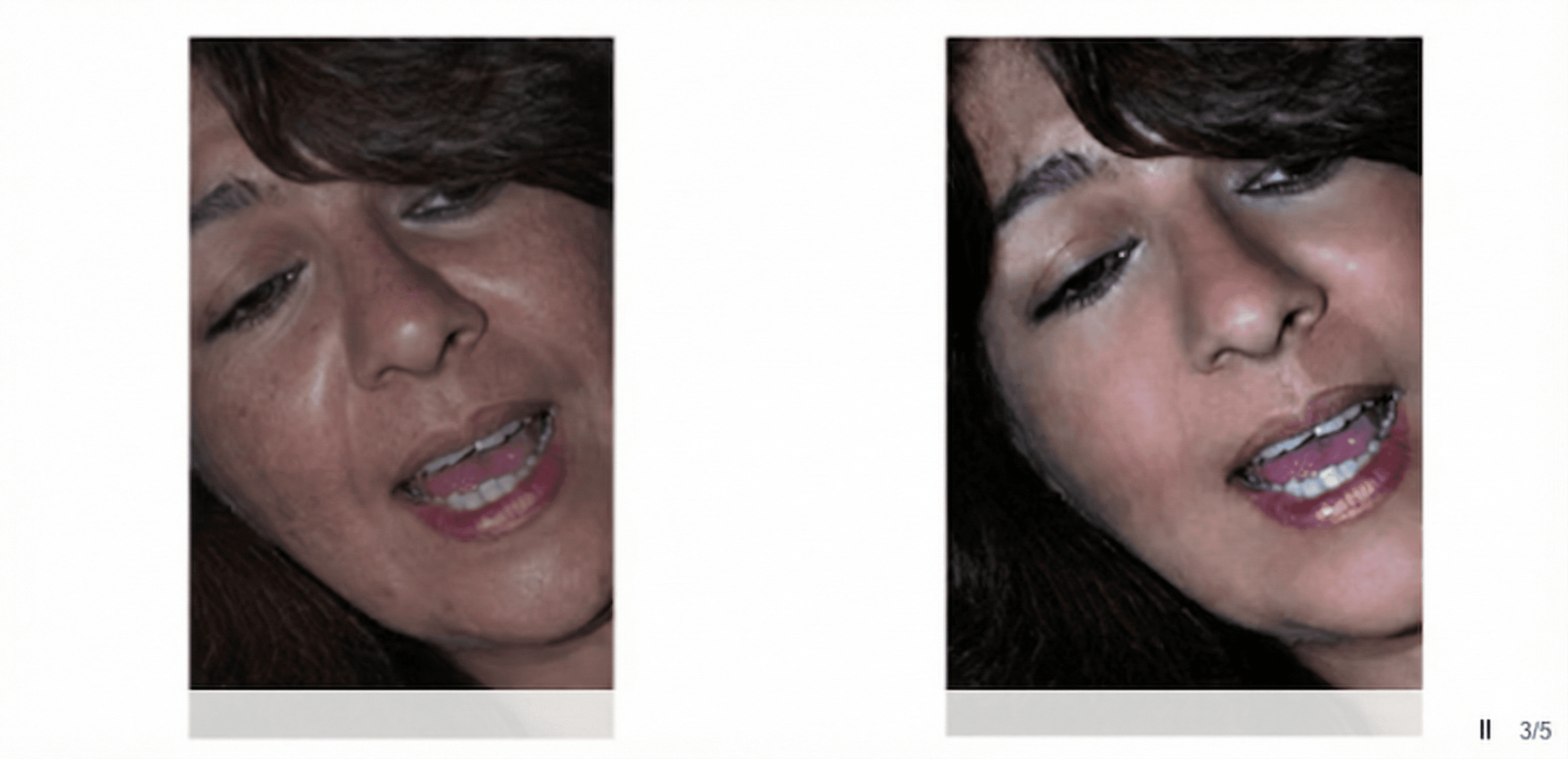 Cosmetic digital surgery example 3